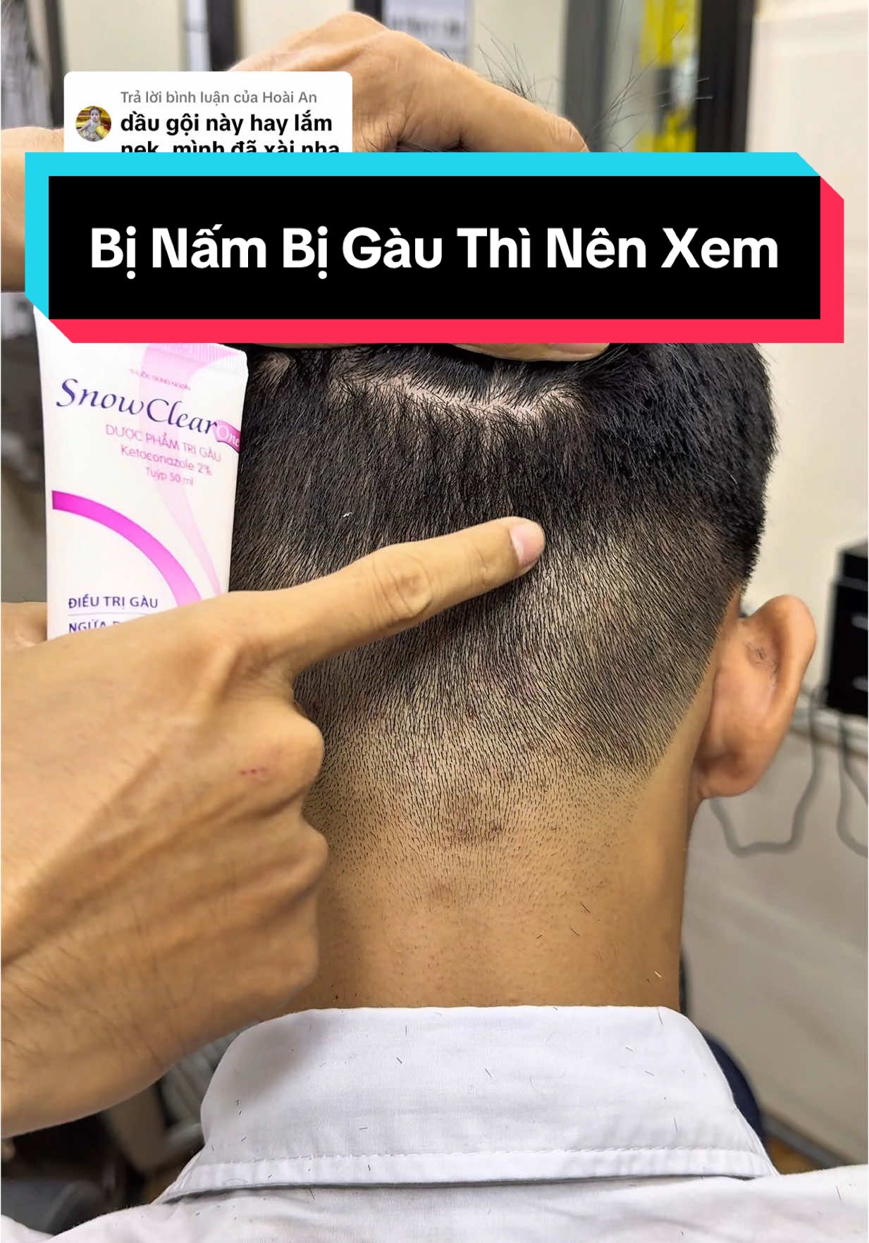 Trả lời @Hoài An Còn rất nhiều Anh Chị vẫn đang khổ sở khi bị gàu và nấm, Hãy gội thử Snowclearone, sẽ bất ngờ vì hiệu quả của nó#snowclearone #gaunamngua 