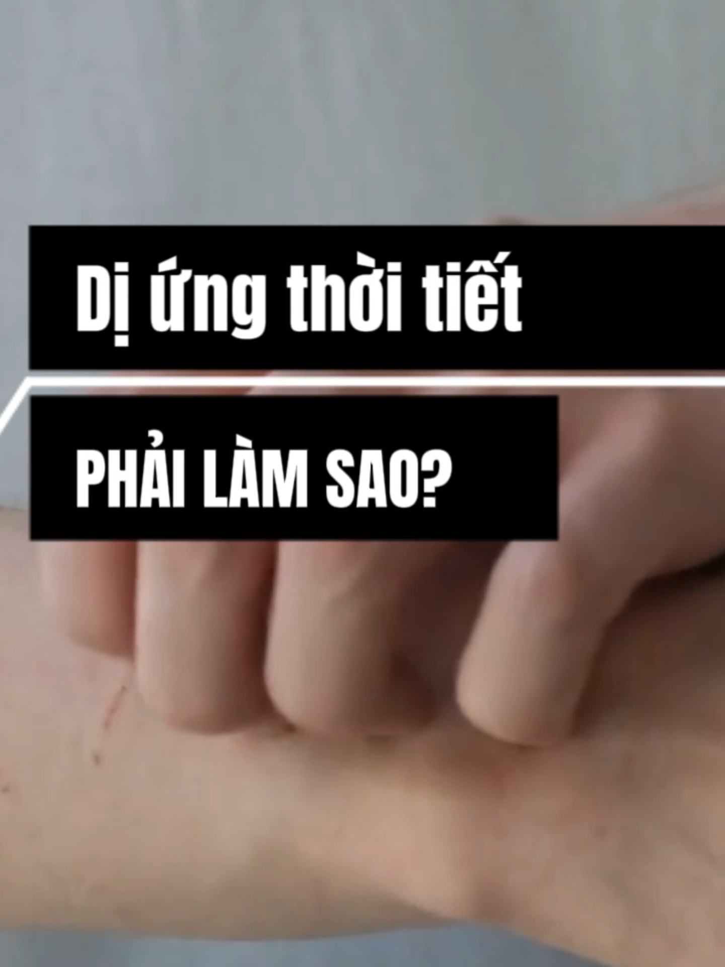 Dị ứng thời tiết phải làm sao? #phubikhang #meday #diung #manngua #mannguameday #diungthoitiet