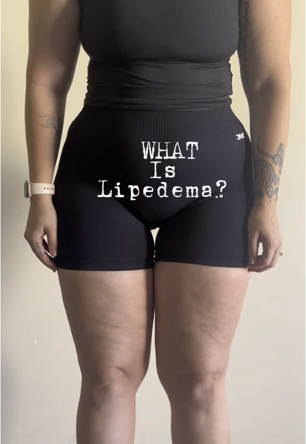 WHAT IS LIPEDEMA?  Lipedema is a chronic medical condition characterized by a build up of adipose tissue (fat) in the legs and arms.  Everyone’s symptoms are different but it can cause pain, swelling and easy bruising. It can be accompanied by an unusual texture within the fat that feels and looks like rice/peas under the skin. This is one factor that makes it different to regular celulite.  Although there is no cure there are steps you can take to manage your symptom’s such as change of diet, low intensity exercise, compression, lymphatic massage, supplements and latest research shows a good outcome in lipedema patients who are using GPL-1 medications.  Follow me as I start on my lipedema journey and learn, heal and support myself and the lipedema community.    #lipedema #lipedemafighter #lipedemalegs #lipedemaawarenes #lipedemalife #lipedemafat #lipedemaeducation #lipedemajourney #fyp 