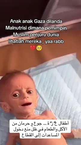 keadaan anak anak di gaza