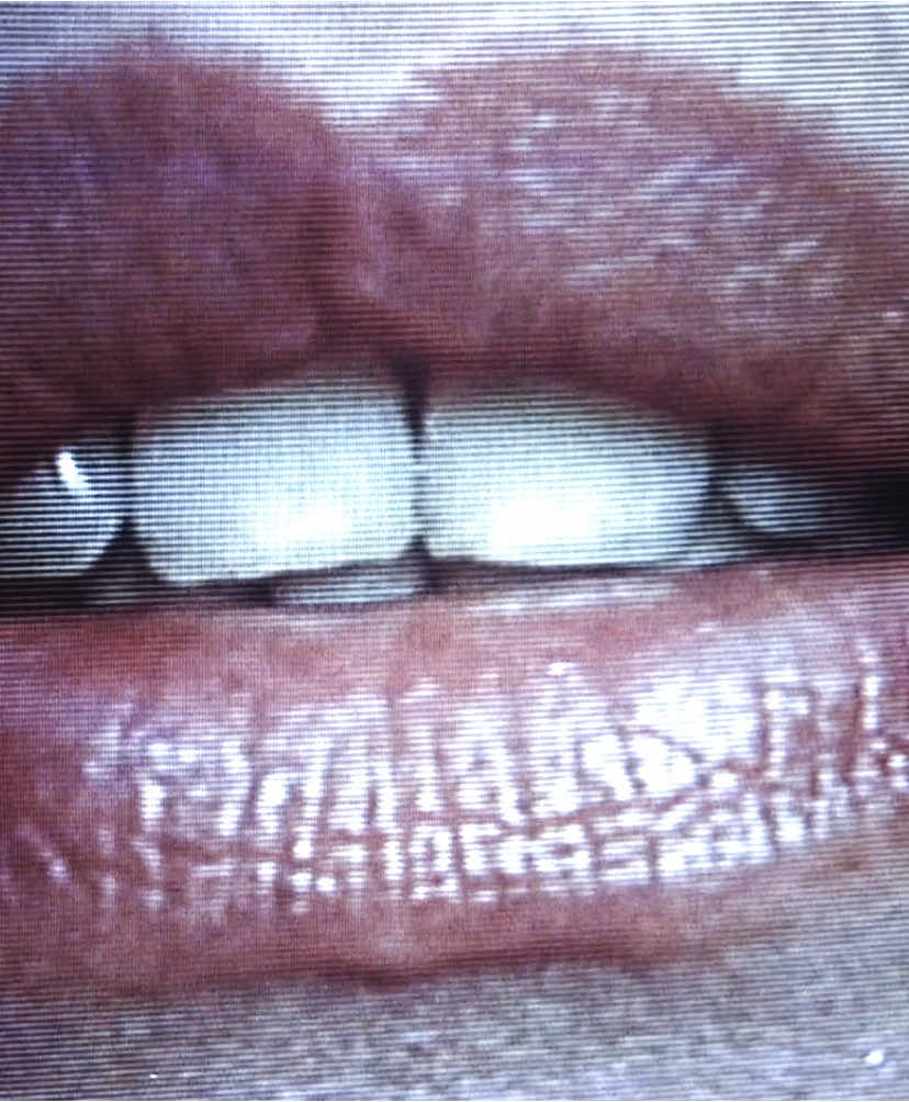 long life to the new flesh #videodrome #davidcronenberg 