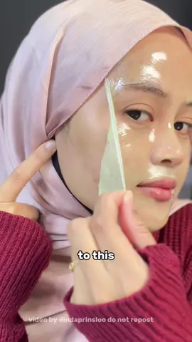 nemuin peel off mask buat redain jerawat & ini tuh ga sakit guys kl di lepas, malah bikin kulit kenyal kaya yogurt 😆 #YogurtPeelOffmask #skincareroutine #viral #kulitcerah #calmingjerawat #pih #pie  