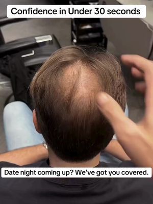 Thinning Hair? Patchy Beard? Wingman™ Gives Instant Results. 