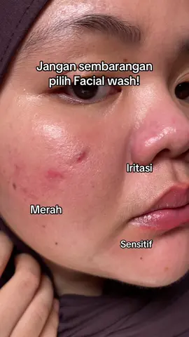 Btw udah ada yang cobain ini belum gais? #sensitivecleanser #kulitsensitive 