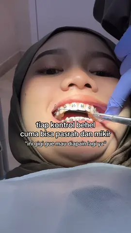 paling deg degan kalo mau dipakein ligature wire sama power chain dan tbtb suruh cabut gigi 😭👋🏻 #gigi #bracketstory #orthodontist 