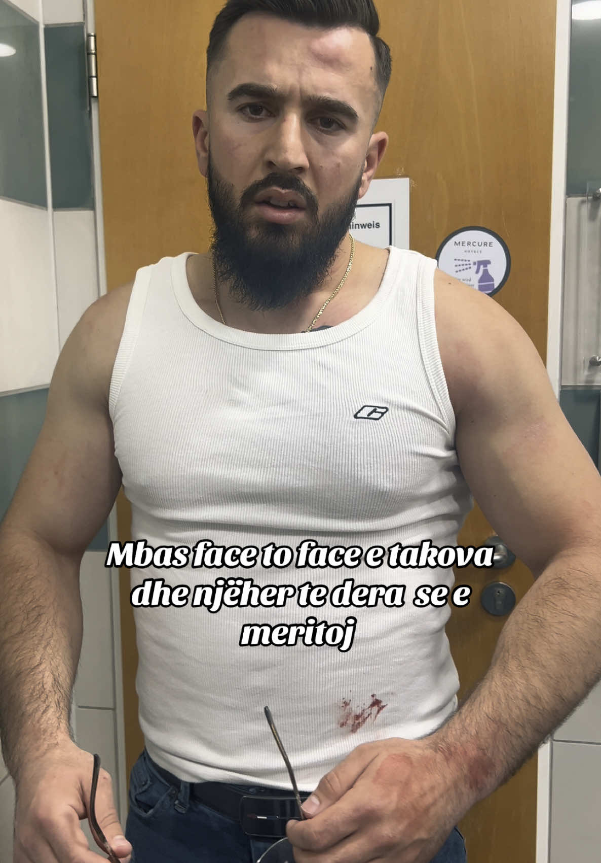 Më provokoj shum në face to face dhe smë lan bodygardat të reagoja shum,por kur përfundoj e zura të dera lepurin .#amarildobakaj 