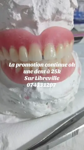 #tiktokchretiengabon🇬🇦🇬🇦🇬🇦 #libreville_gabon🇬🇦 #prothesesdentaires #videovirale 