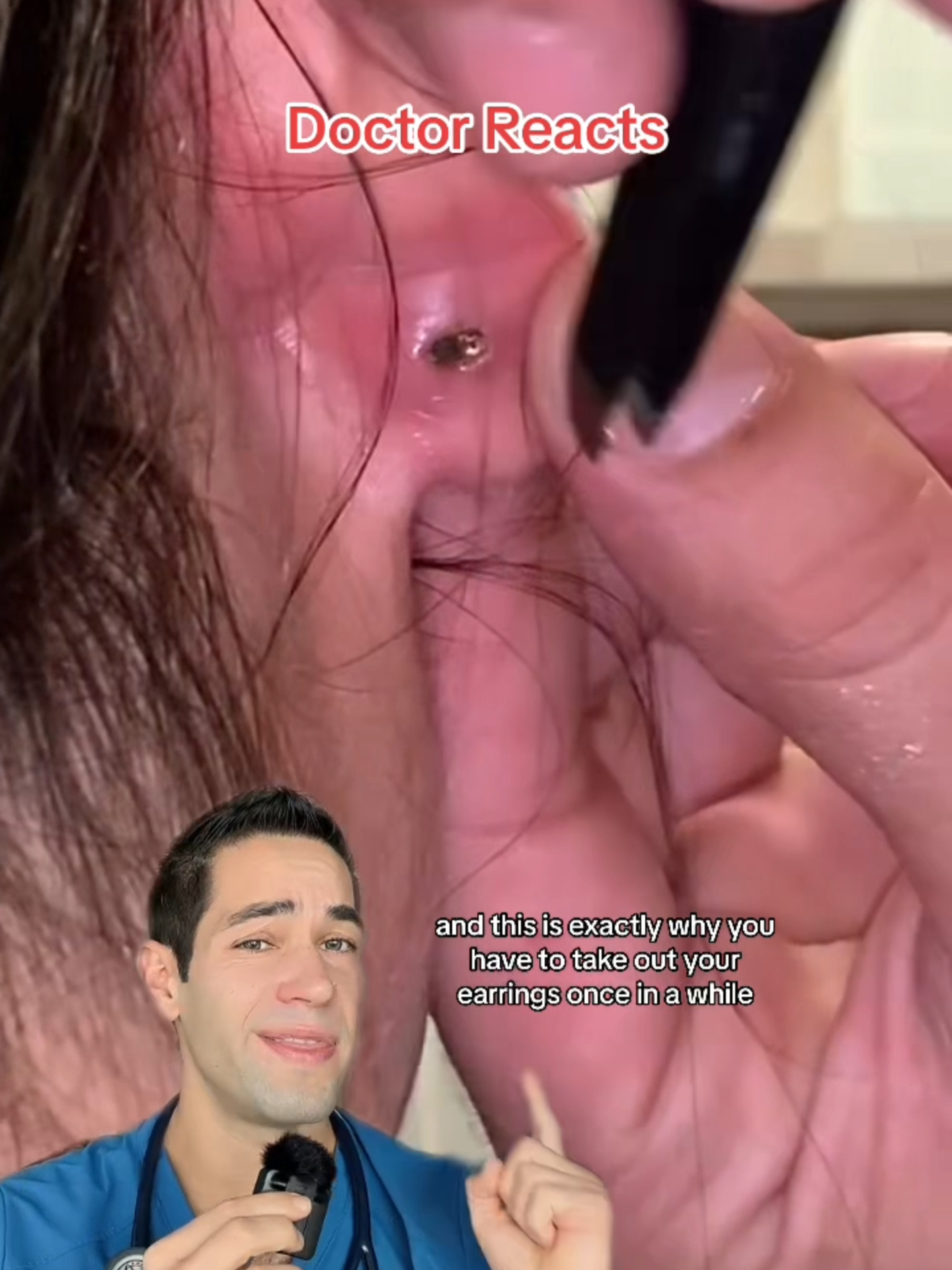 Have you taken out your earrings recently? #earrings #safety #medical #health