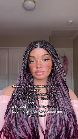 Growing up insecure about my scars, I often felt like I had to make up for them somehow. I believed if I could just be the funniest or friendliest person in the room it would distract from something I hadn’t yet learned to accept in myself. Looking back, I realize how hard I was trying just to be seen for more than what hurt me😔 #princessuweee #burnsurvivor #selflove 
