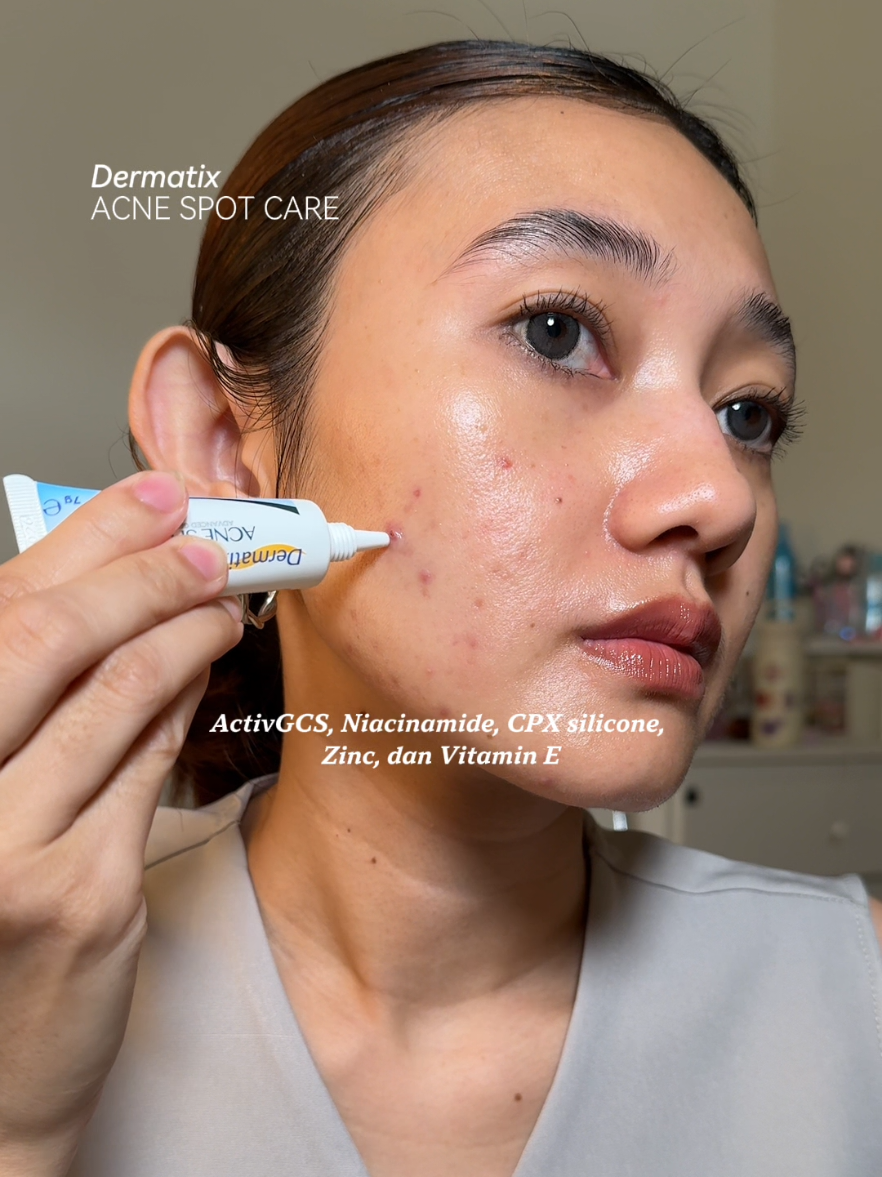 Siapa yang jerawatnya cepet sembuh, tapi bekasnya malah menghitam? Yuk, cobain Dermatix® Acne Spot Care yang di pakai @randomngulah 