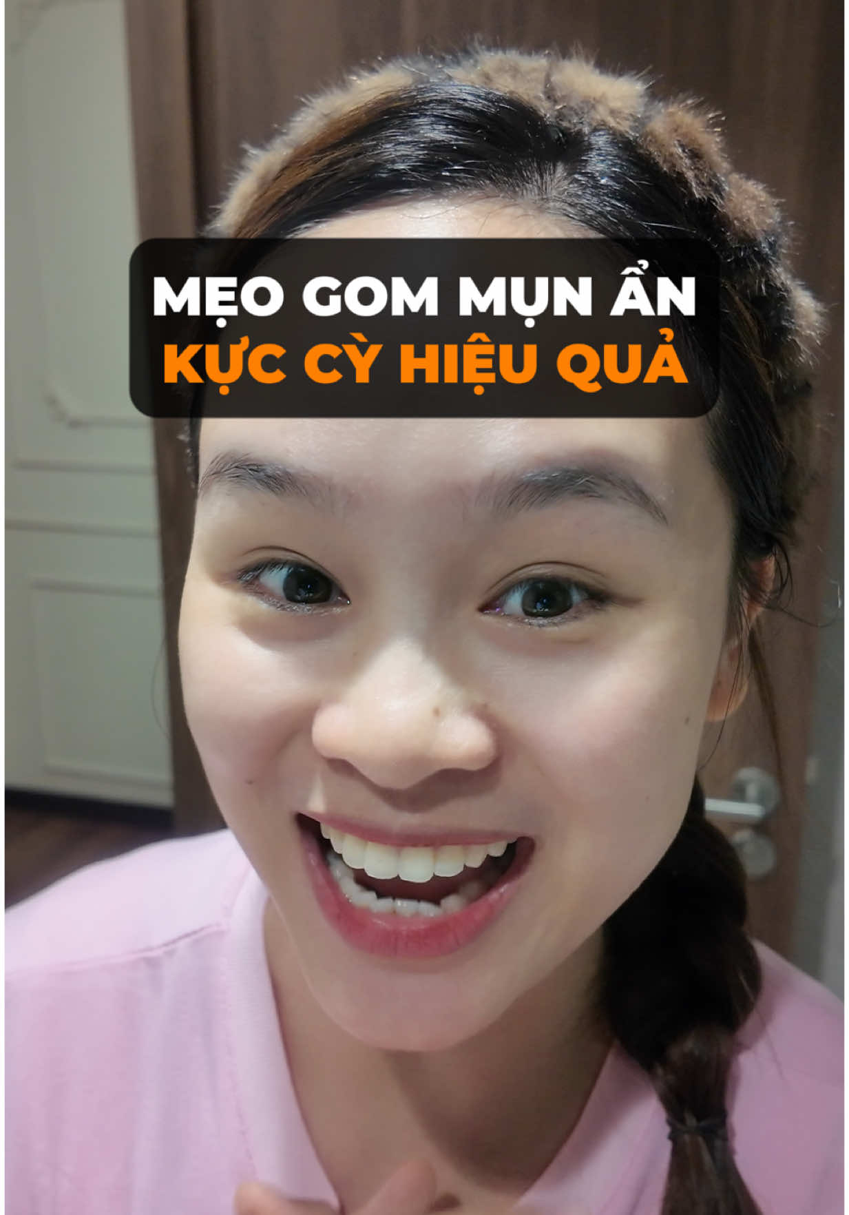 Nạn nhân của mụn ẩn nhất định cần phải xem video này #congoanchamda #hoangngoan #munan 