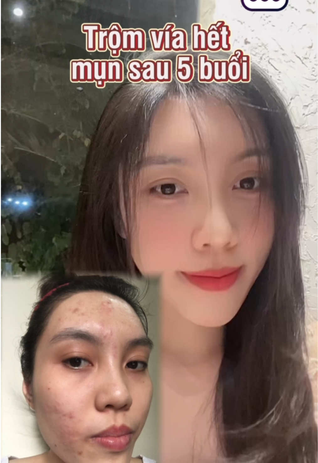 Mùa hè tới rồi chăm da còn đi du lịch sống ảo thui chị em ơi 🔥👯 #nexnow #nex #booking #mimosa #spa #LearnOnTikTok #lamdep #trimun 