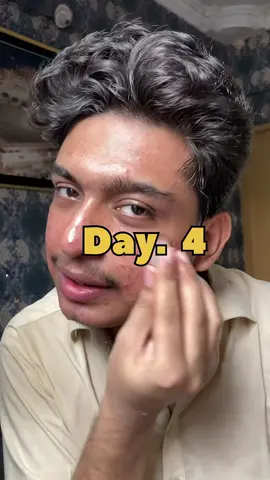 Transforming my face, one day at a time 🔄 Day 4 update! #100DayGlowUp #MaleFaceTransformation #SkincareJourney #GroomingEssentials #FaceTransformationChallenge #GlowUpChallenge