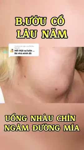 Trả lời @FB Mai Nguyễn TIN VUI CHO CÔ CHÚ ANH CHỊ ĐANG BỊ B.ƯỚU CỔ, TUYẾN GIÁP, CƯỜNG GIAP, U SƠ U NANG U NGỰC, HẠCH Ở CỔ.  #daunhucxuongkhop #baithuocdangian #baithuochay #saytran84 