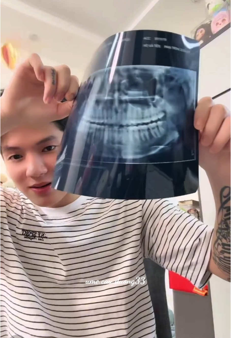 đau răng nhưng bướng🤦🏻‍♀️🤦🏻‍♀️@Trọngg Dươngg #trongduong #trongduonglive 