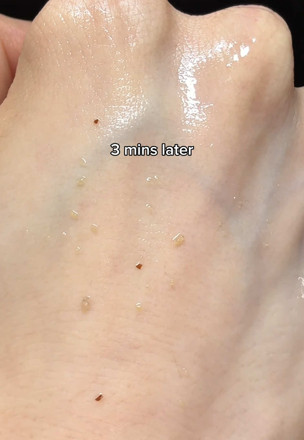 pore cleansing day🧼 #doublecleansing #doublecleanse #cleansing #cleansingoil #cleansingfoam #skin1004 #pores #porecleansing #tiktokmademebuyit #glassskin #koreanskincare #fyp  @SKIN1004 US 