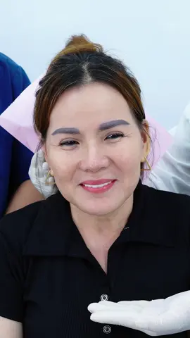 Giúp chị thay đổi khuôn mặt thay đổi số phận với Cấy mỡ tự thân #caymo #caymomat #cangda #cangdamini #thammy #viral #xuhuong 
