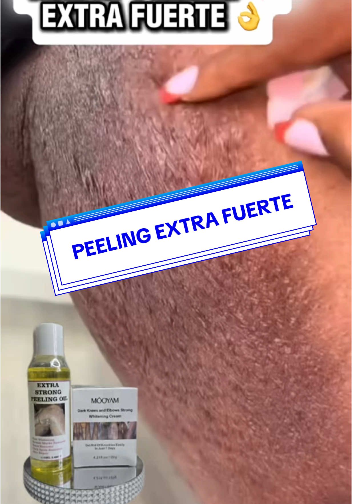 KIT: $35 Panamá  •Peeling Extra Fuerte $19.99 de 100ml •Crema despigmentante $19.99 de 120ml USE CON RESPONSABILIDAD  El aceite exfoliante se puede utilizar para todas las partes del cuerpo, como manos, brazos, codos, piernas, rodillas y pies. Ayuda a que tu piel oscura se vuelva joven y luminosa. Y el producto puede ayudar a la piel oscura a que l se vuelva más brillante y radiante.  instrucciones: 1. Aplique el aceite exfoliante  uniformemente sobre la piel y espere 15 minutos.  2. luego enjuague con agua. Utilice el aceite exfoliante  tres veces al día. Mañana, Mediodía y Noche. 3. Es necesario utilizar el exfoliante cutáneo  durante 3 a 7 días consecutivos.  4.Utilice la crema o loción hidratante e iluminadora para obtener un mejor resultado.  NOTA: Siga las instrucciones del reverso del envase. Para que puedas ver el sorprendente efecto.  👉🏻No uses el exfoliante en el área donde aplicaste el aceite exfoliante. Espere de 5 a 7 días para que se despegue la piel áspera.  💥Por favor, no despegue la piel con la mano  haga que la piel se despegue de forma natural.  *Importante*  Preste atención a la protección solar cuando utilice el aceite peeling No exfoliar la piel mientras esté en tratamiento  usar crema hidratante  *Use bajo su criterio* Envíos a todo el pais #saludpielybelleza  #pielradiante #peelingnatural #pielsaludable #manchas  #antimanchas #ventaspanama #100%natural #aceitepeeling