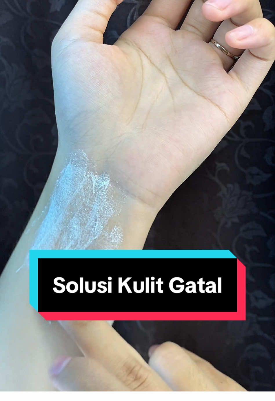 Gatal? Oles aja Cream Bidara Sirih 🌿 Pakai 2–3x sehari, gatal langsung reda! #CreamBidaraSirih #ObatGatalAlami #GatalReda #FYP #SkincareHerbal 