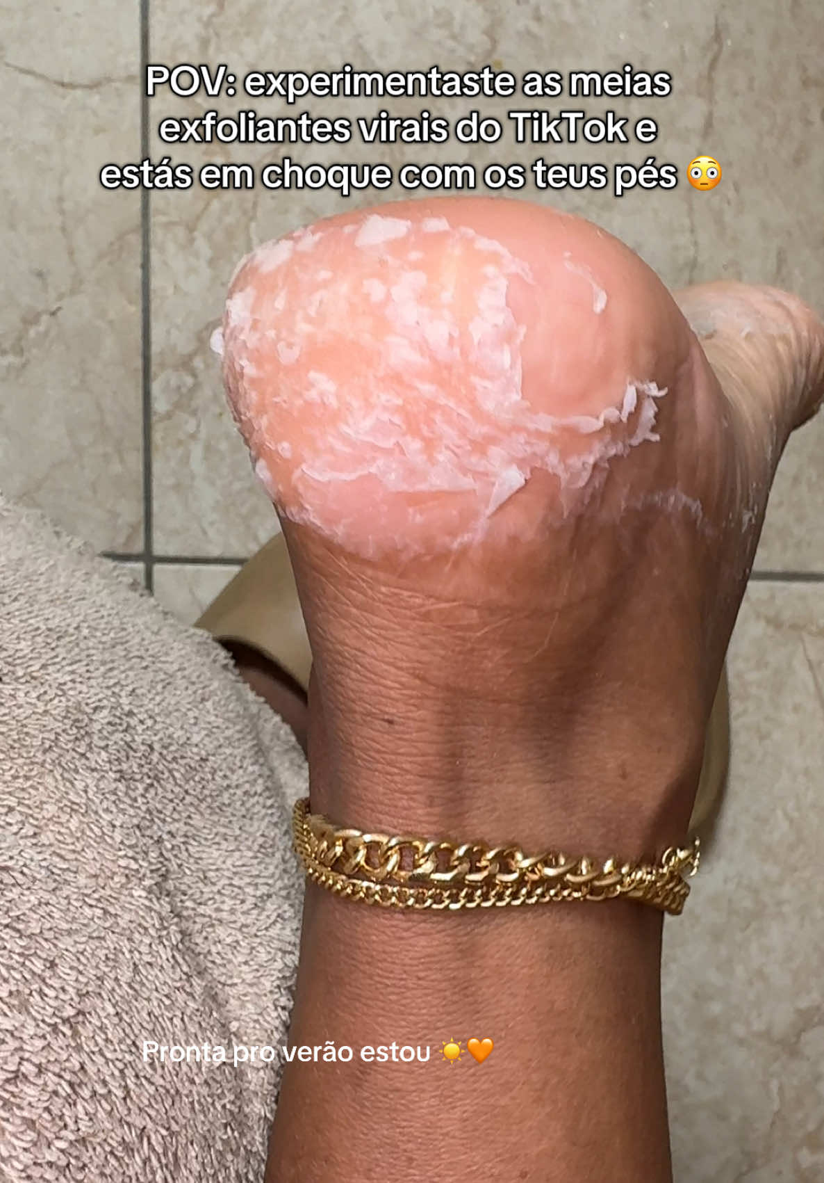🧦 Testei as meias foliantes virais e o resultado? Simplesmente uau! A pele sai todinha parece magia 😱✨ Se tu também amas aquele momento de transformação real, PRECISAS ver isso! #satisfatório #pelelisa  #PeelingFeet #MeiasFoliantes #SkincareDosPés #PeleNova #PeelingViral #AntesEDepois #BeautyHack #PeleDeBebê #SelfCare #FootCareRoutine #PeelingSatisfatório #FeetTransformation #TikTokBeauty #skincareasmr 