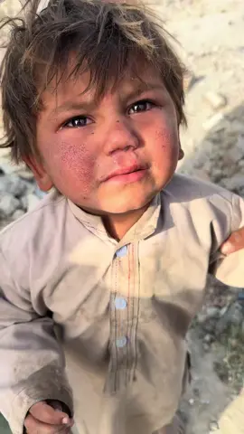 💔 #afg #afghanistan🇦🇫 #afghan #afghanboy 