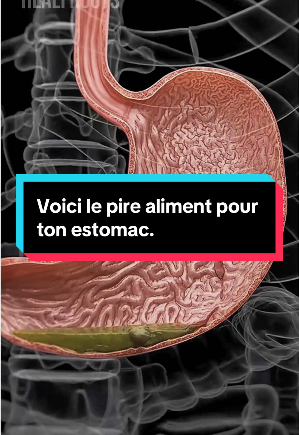 Le pire aliment pour ton estomac, sans que tu t’en rendes compte. Ce n’est ni le café, ni les plats épicés. Elle est sucrée, gazeuse, acide, et tu en bois peut-être tous les jours. Son acidité attaque progressivement ta muqueuse gastrique. Et à long terme, elle peut favoriser les reflux, les inflammations et l’inconfort digestif. Elle contient des additifs qui perturbent l’équilibre de ton estomac.