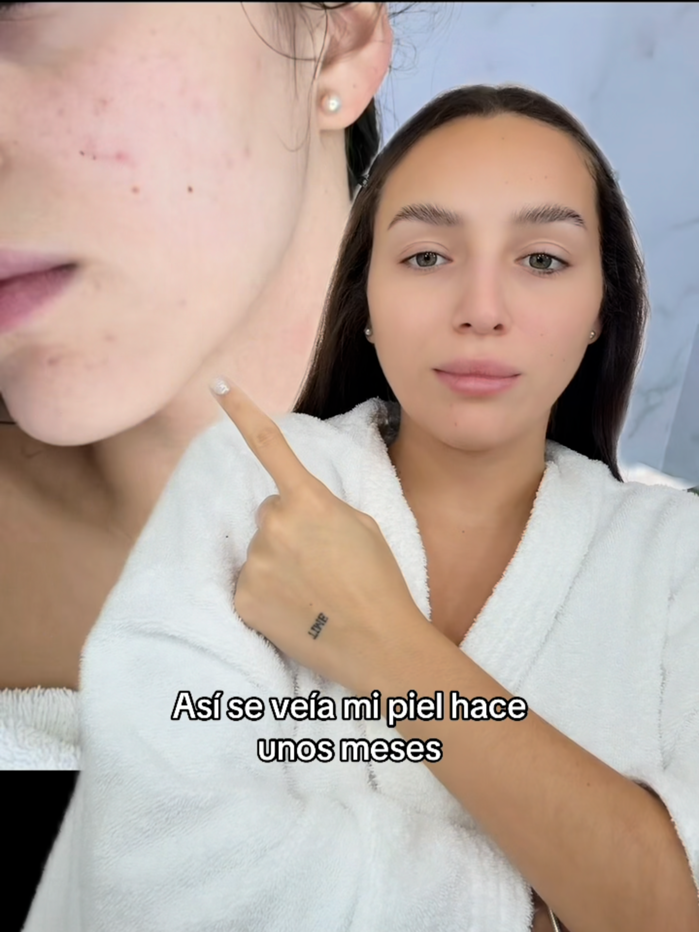#tonicoexfoliante #AnuaArgentina #Kbeauty #GentleByNature #EffectiveByScience #AnuaCienciaEnTuPiel #Argentina #Lanzamiento #Skincare #Anua #GlassSkin #TesteoAnua #antes y despues #BHA #pielsensible #pielmixta #pieloleosa #acneskin