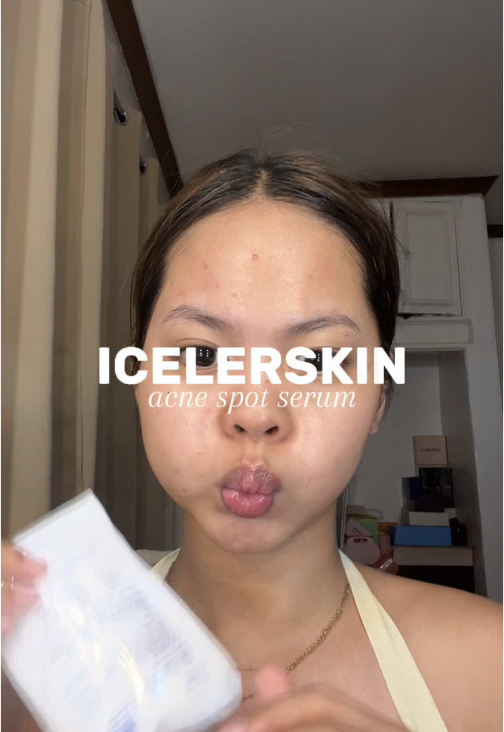 it drys out pimples fast! 💋✨  @ICELERSKIN.PH  #icelerskinph #acneserum #goodbyepimple