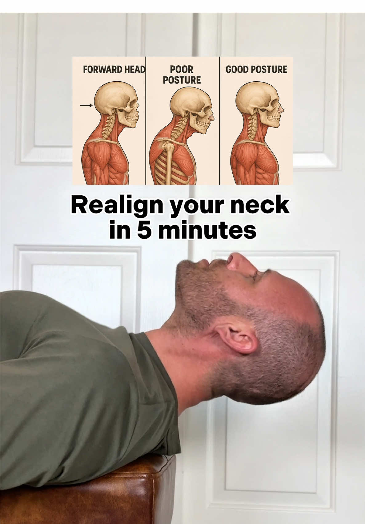 Realign your neck in five minutes  If you’ve got forward head posture from too much phone time, desk work, or just everyday life—this one’s for you.  These 5 corrective exercises help reverse the damage, decompress your neck, and bring your head back into proper alignment.  No fancy equipment—just a bed and your body. Here’s what we’re doing: 1. Chin Tuck Extensions – reset your neck curve 2. Side-Lying Neck Lifts – strengthen neck stabilizers 3. Gravity Chin Tucks – improve alignment 4. Chin Tuck + Rotation – build control through movement 5. Cats & Dogs (Hip to Head Flow) – reconnect the spine from the ground up Do this routine daily and feel the difference! #forwardheadposture #posturefix #neckpainrelief #postureexercises #techneck #roundedshoulders #anteriorpelvictilt #postureguy #correctiveexercise #spinalalignment #posturecheck #neckmobility #posturecorrection #headforwardposture #posturecoach #posturematters