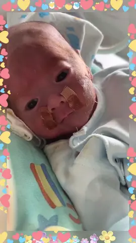 “Please 🥺 We need more time… more 🥺 He doesn’t have much time…”#help#baby#Love#mother