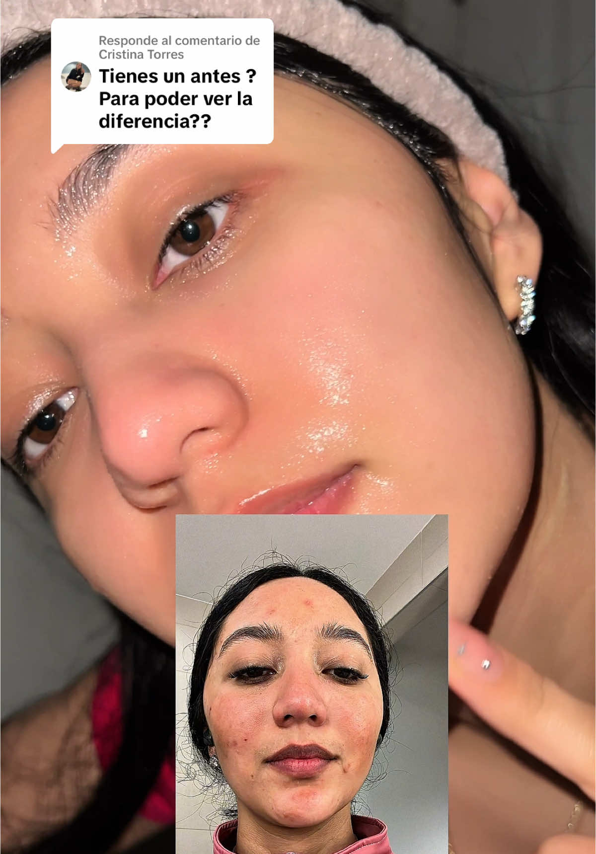 Respuesta a @Cristina Torres #melasma #melasmatreatment #melasmaskincare #tumericsoap #curcuma #manchasenlapiel 