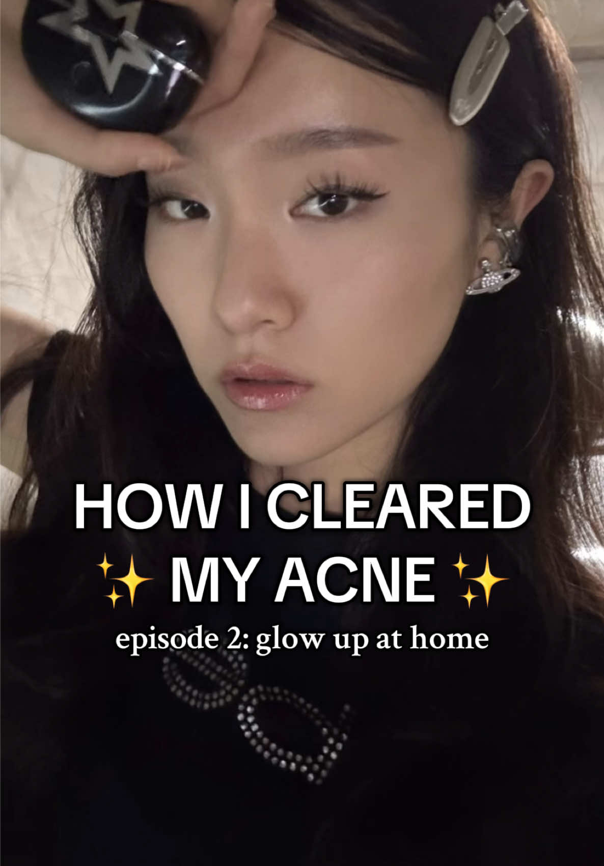 HOW I CLEARED UP MY SKIN AND ACNE at home :) (ep 2 of glowing up at home) and what works for me may not work for you so pls take everything lightly 💗 #glowuptips #acne #skincaretips #GlowUp 