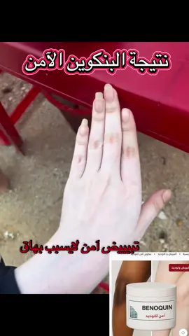التبييض والتوحيد الجذري مع البنكوين الآمن#ترند_تيك_توك #اكسبلورexplore #اكسبلورر #تبييض_بشرة #تبييض_البشرة_و_الجسم #بنكوين #السعودية #fyp #you #4u 