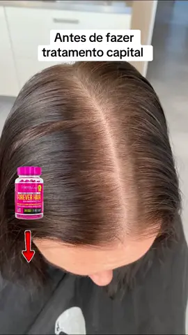 ✨ Cabelos Fortes, Longos e Radiantes Todos os Dias! ✨ Chegou o queridinho das mulheres que não abrem mão de um cabelo saudável e poderoso: Forever Hair da Forever Liss! 🌸 💊 Com fórmula ultra concentrada e importada, cada cápsula é um verdadeiro boost de vitaminas e minerais essenciais para: ✅ Crescimento acelerado dos fios ✅ Fortalecimento profundo da raiz às pontas ✅ Fim da queda e quebra capilar ✅ Unhas mais fortes e resistentes 🔥 6x mais eficácia comprovada! 📦 Contém 30 cápsulas – tratamento para 1 mês 🇺🇸 Produto importado com qualidade premium 🌟 Ideal para quem busca beleza de dentro pra fora! 👉 Transforme seu cabelo e autoestima com apenas 1 cápsula por dia. Garanta já o seu Forever Hair e comece a ver resultados em poucas semanas! #cabelo #cabelosaudavel #cabelofino #cabelocaindo #crescimentocapilar #saude 