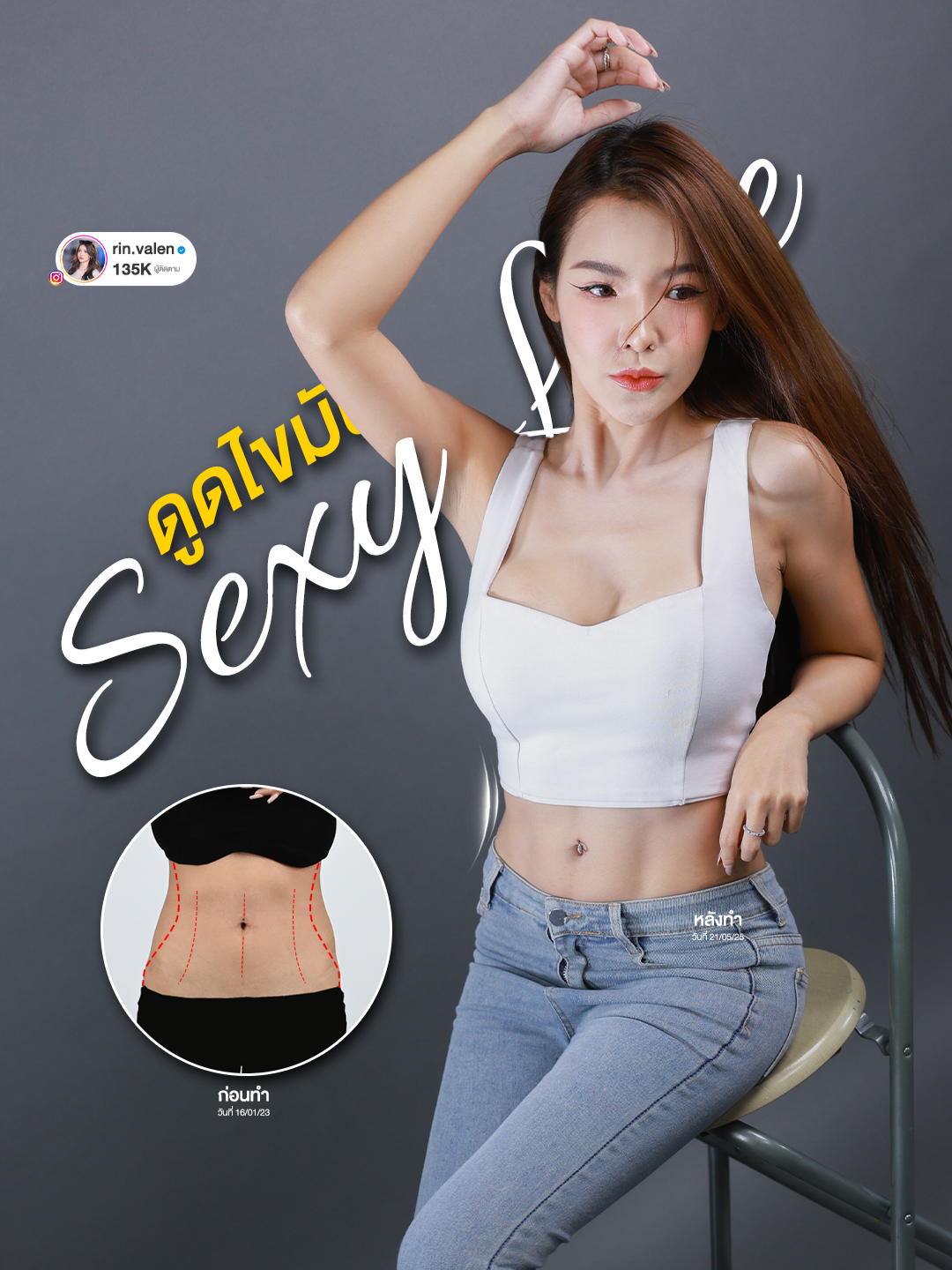 หลังทำ Sexy Line เอวเอส ครบ 1 ปี 6 เดือน มัน Wowww มากกกกกกก ไปฟังไปดู ดูจบแล้วทักมาถามโปรได้เลย #เอว36 #SexyLine #ร่อง11 #masterpiecehospital