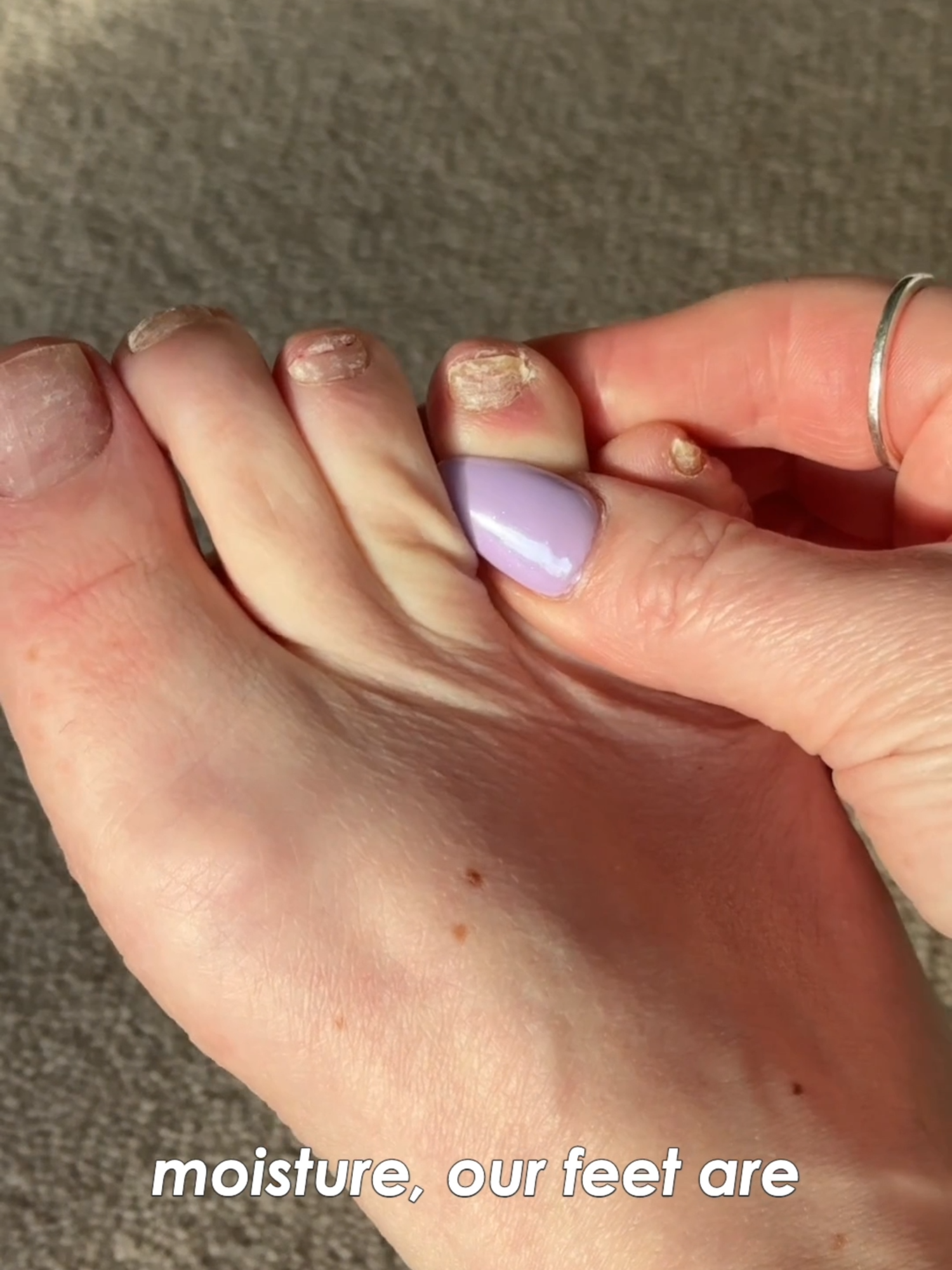 A natural oil blend, made with traditional antifungal botanicals like oregano, tea tree, lemongrass and clove, to keep skin and nails healthy 🌿 #fungalnail #fungaltoenail #fungalinfection