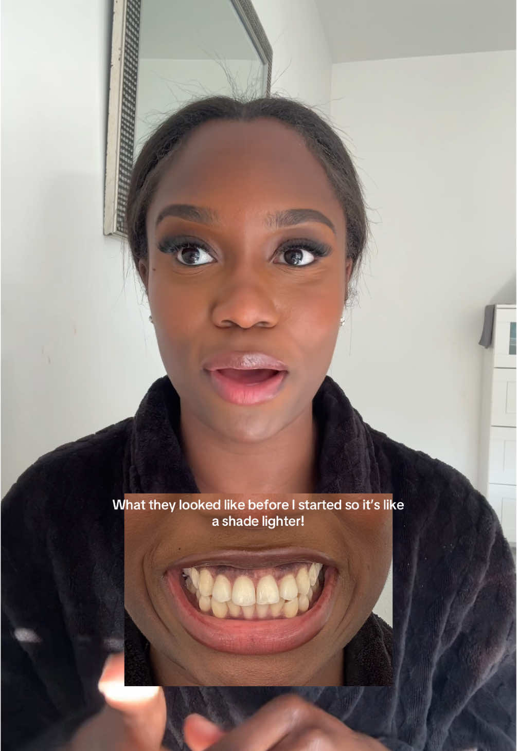Looking at the picture from how it looked when i started I’m actually surprised that they worked so well!   #whiteningstrips #tiktokmademebuyit #dealdrops 