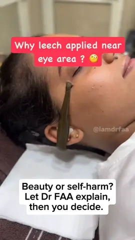 Doctor Explaining Leech Therapy | Beauty or Harm? #iamdrfaa #doctorreacts #leechtherapy  #wellnesscoach #wellnesstrends  #doctor #healthtips #medicaleducation #LearnOnTikTok #doctorexplains #fypviralシ  #creatorsearchinsights 
