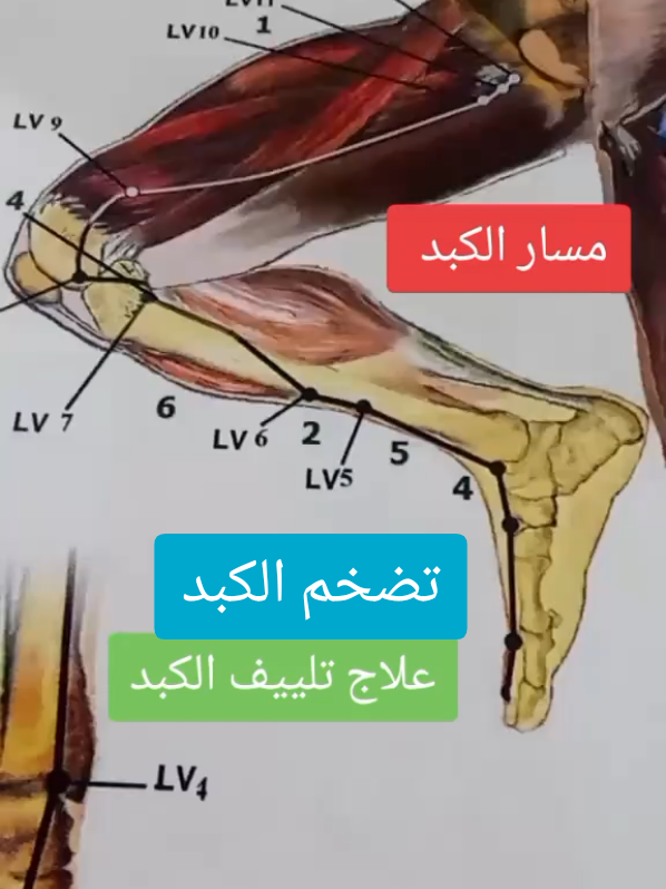 نصائح ابو عمر الطب العربي الوخز بالإبر الصينية والاعشاب الطبيعية والحجامة  #المغرب🇲🇦تونس🇹🇳الجزائر🇩🇿 #الطب #الصيني #الحجامة #اعشاب_طبيعيه #الرقية_الشرعية #