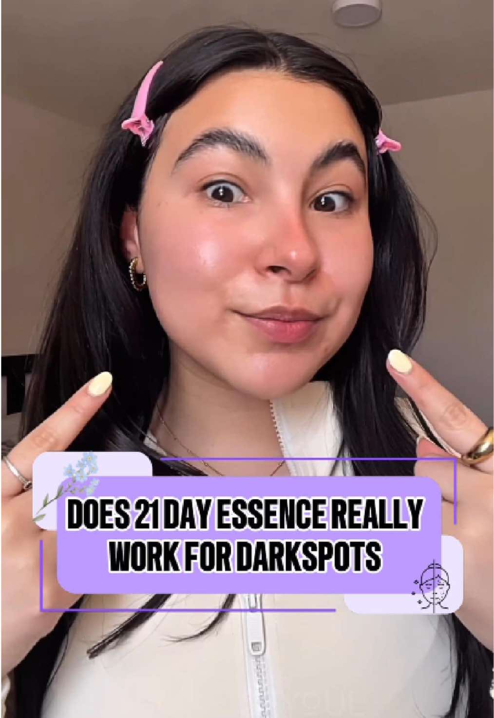 ✨ Glow or No? Let’s See the Real Me After 21 Days! ✨#seyoulph #seyoulserum21days#21daysessencce #serum21days #skincareph #melasmatreatment #skincareph #glowingskin  #transformation