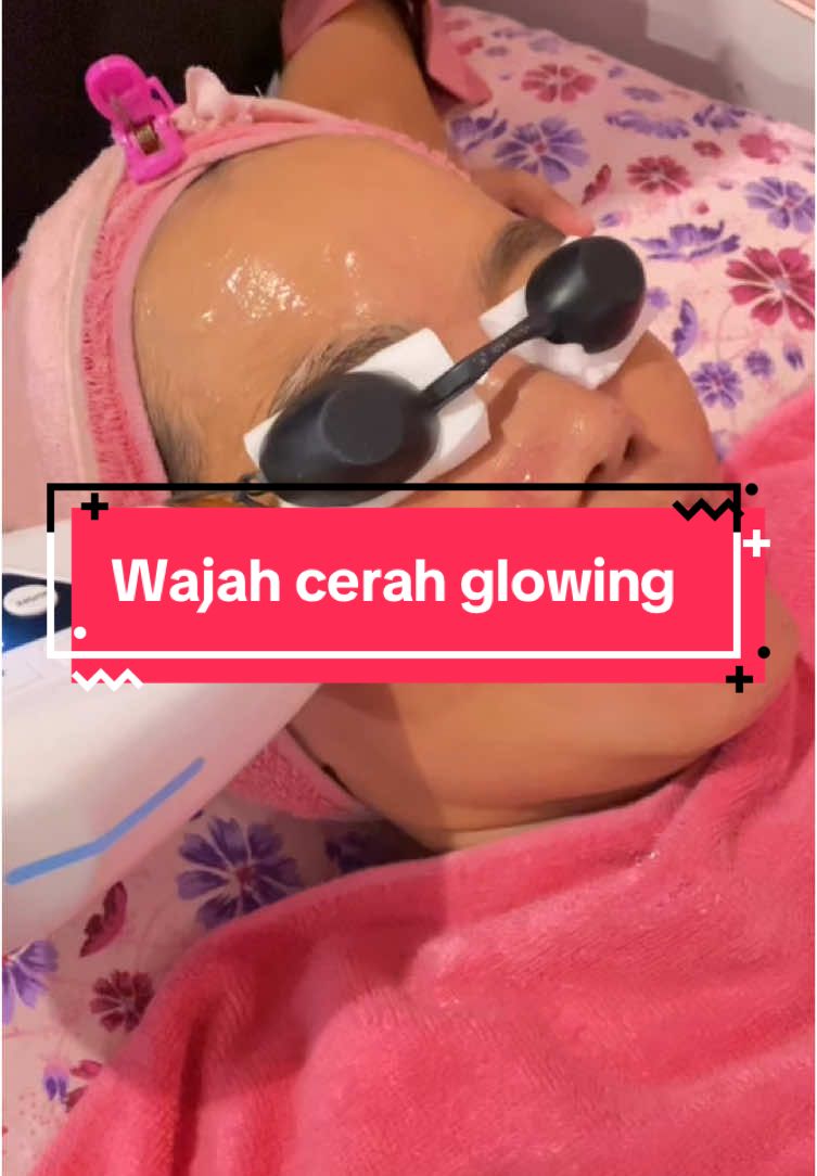 IPL WHITENING solusinya😍 #ipl #iplwhitening #facial #perawatanwajahglowing #CapCut 