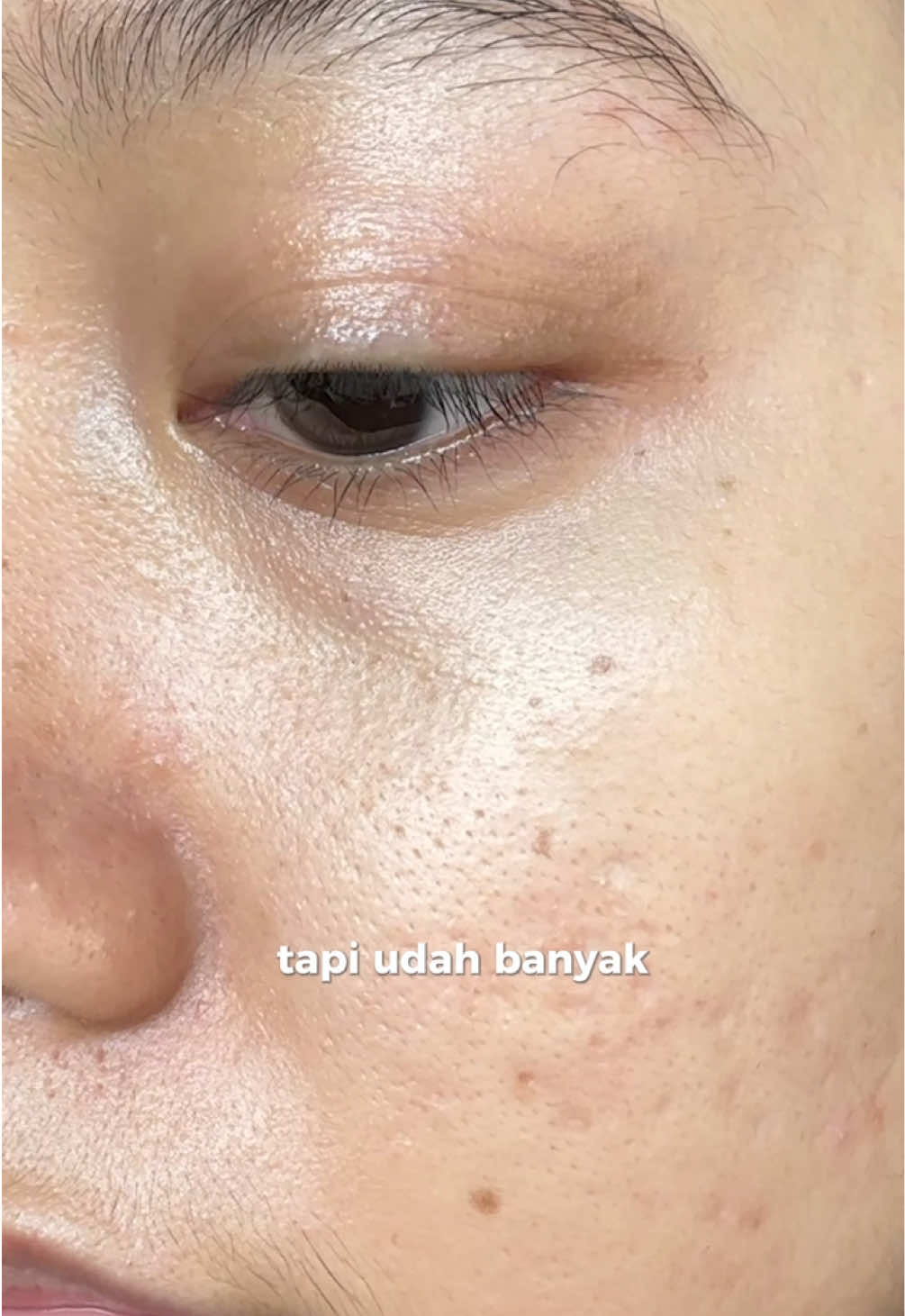 gamauuu tua sebelum waktunyaa😖😖🫵🏻 #forskinssake 