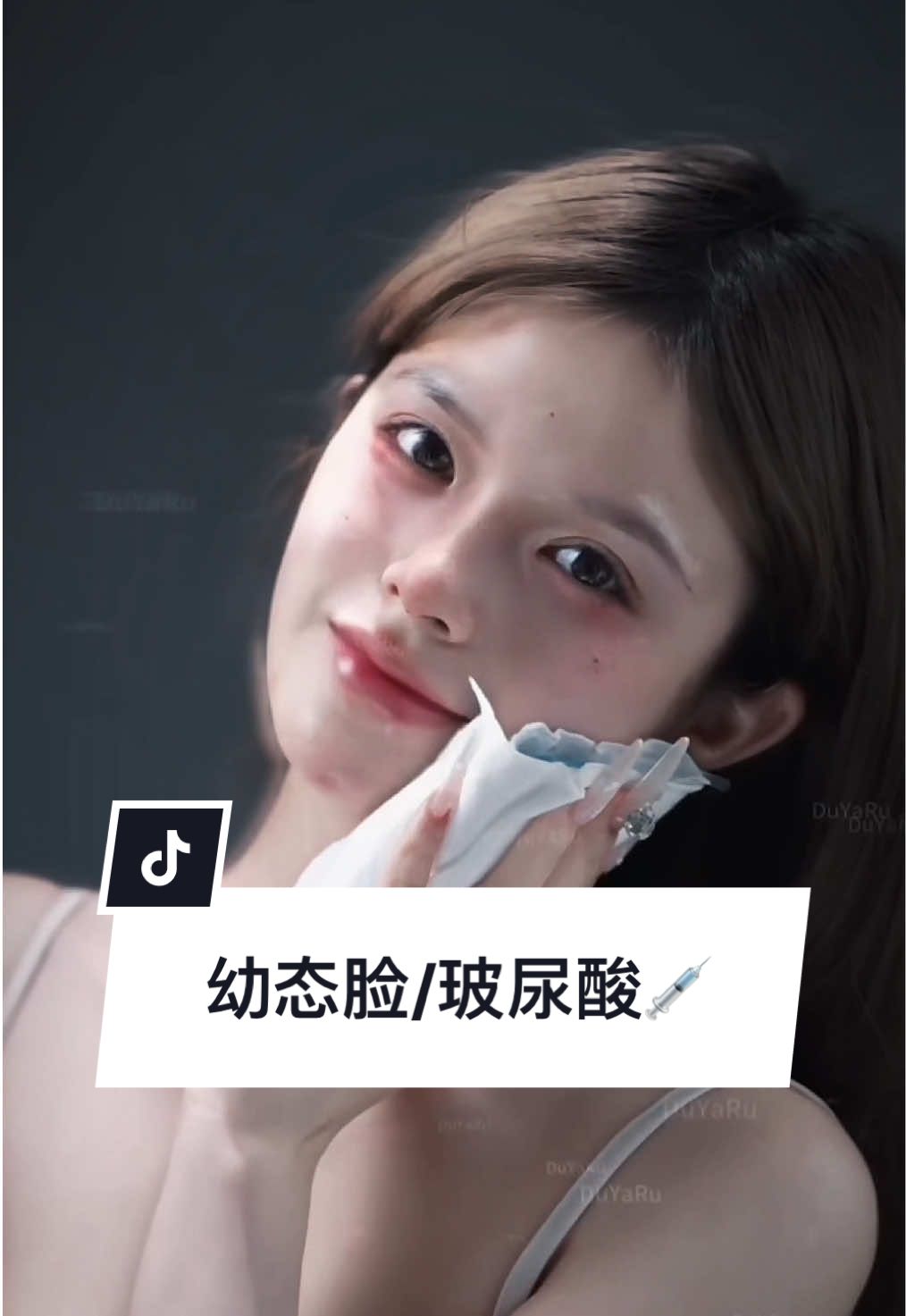 幼态感，高级了，#fyp #capcut #卧蚕 #幼态审美 #变美 #ịnectables #fillers #fillers💉 #tiembotxo #tiemfiiler 