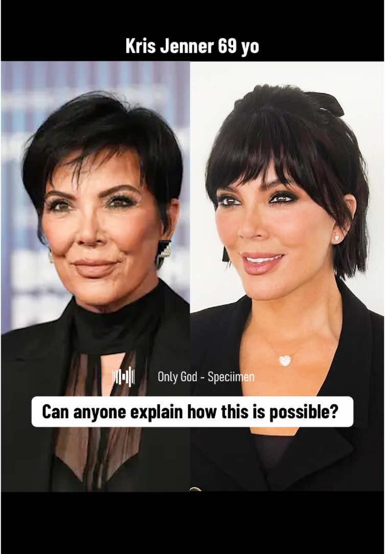 Can anyone explain how @Kris is getting younger time? ✨🪄 #krisjenner #celeb #celebrity #beforeafter #kardashian 