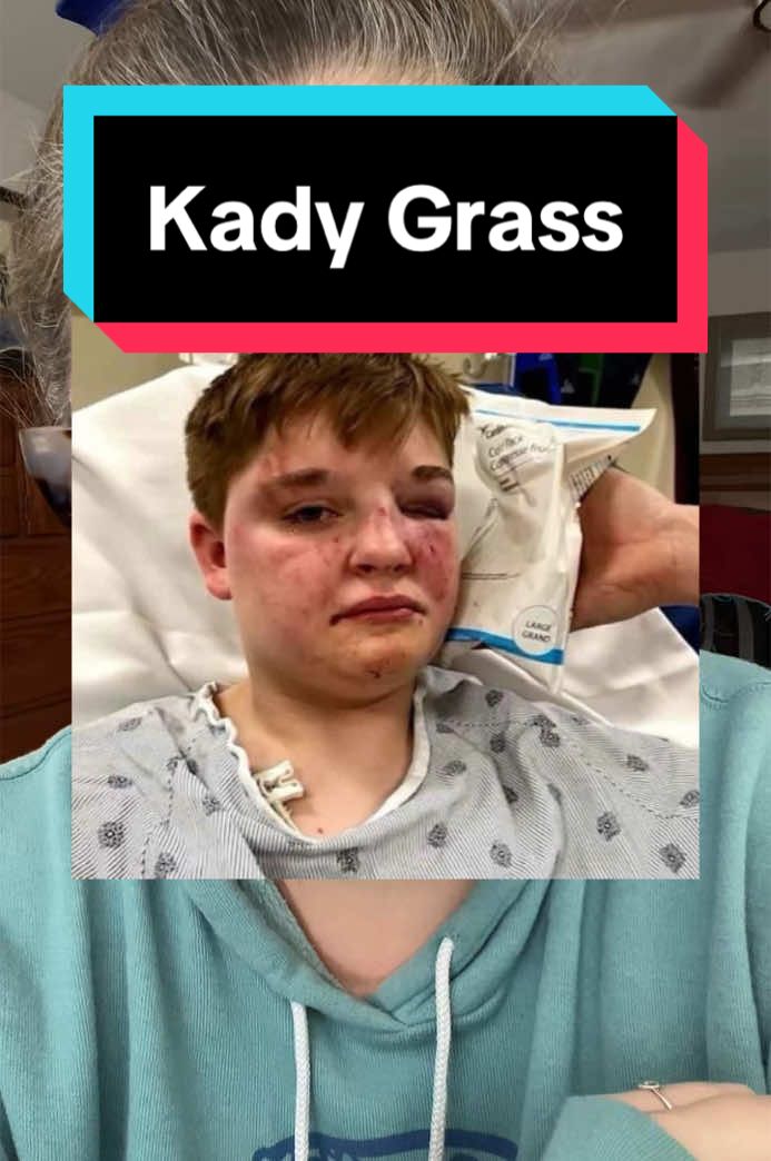 Trans rights are HUMAN RIGHTS!  #kadygrass #illinois #lgbtq #transright #lgbtqnews 