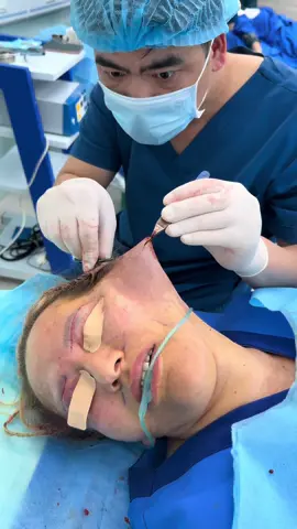 #drlee #fullfacelift #tiktokviral #tiktokphilippines🇵🇭 