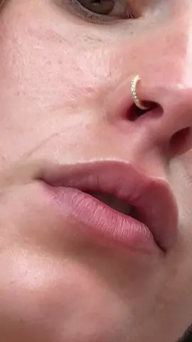 #kiss 