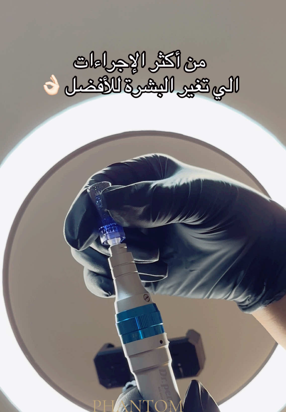جلسة مايكرونيدلينغ لتحفيز الكولاجين، تقليل آثار الندوب، وتوحيد لون البشرة.❤️‍🔥 #بريطانيا_لندنlondon🇬🇧🇬🇧 #عيادة_تجميل_لندن #ديرمابن #viral #fyp #عيد_الاضحى #الشعب_الصيني_ماله_حل😂😂 #لندن 