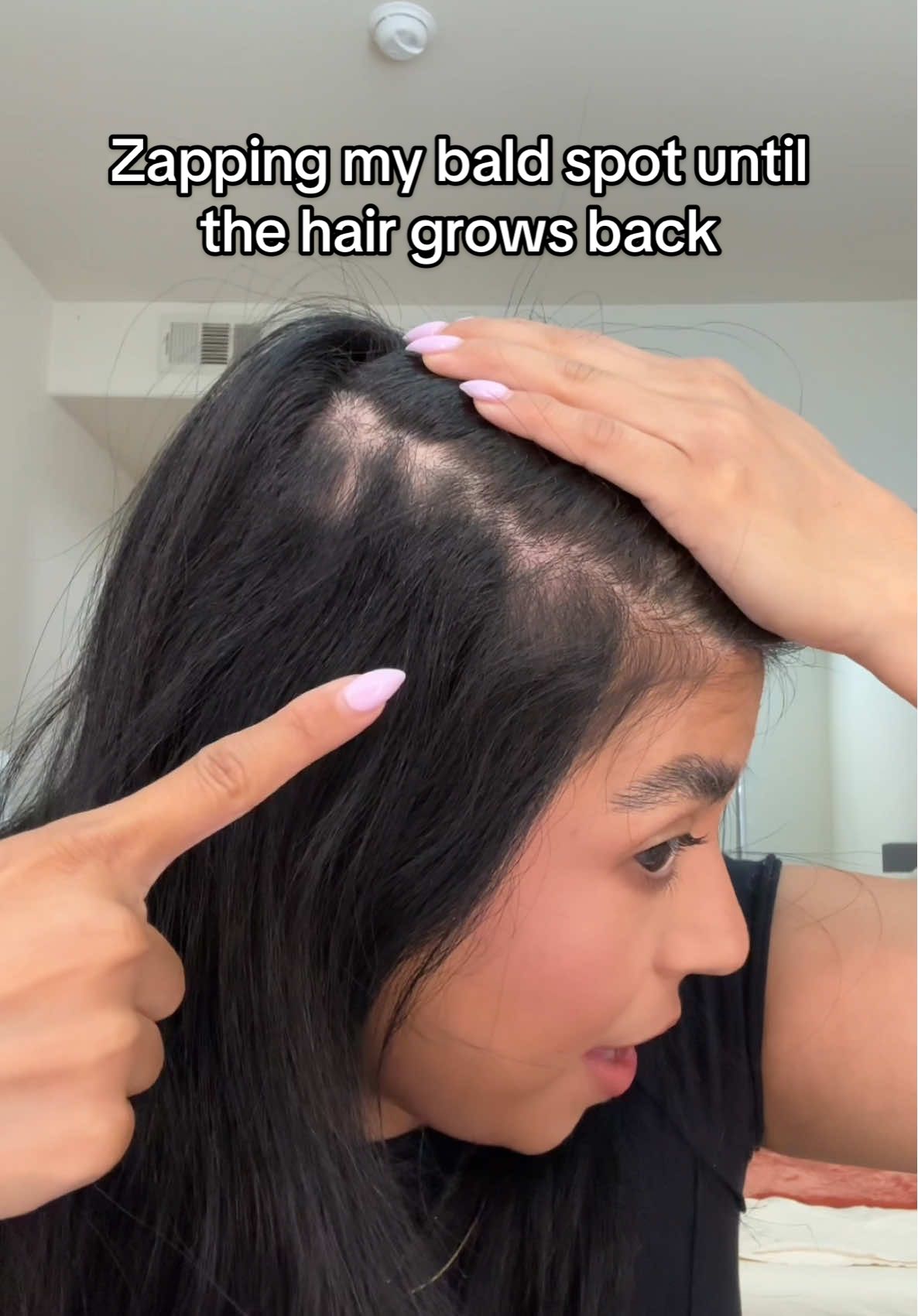 I added a new step to my hair care routine #haircare #kerastase #highfrequency #baldspots #alopecia 
