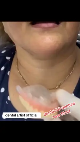 #full #dental #partial #teeths #denture #foryoupage❤️❤️ 